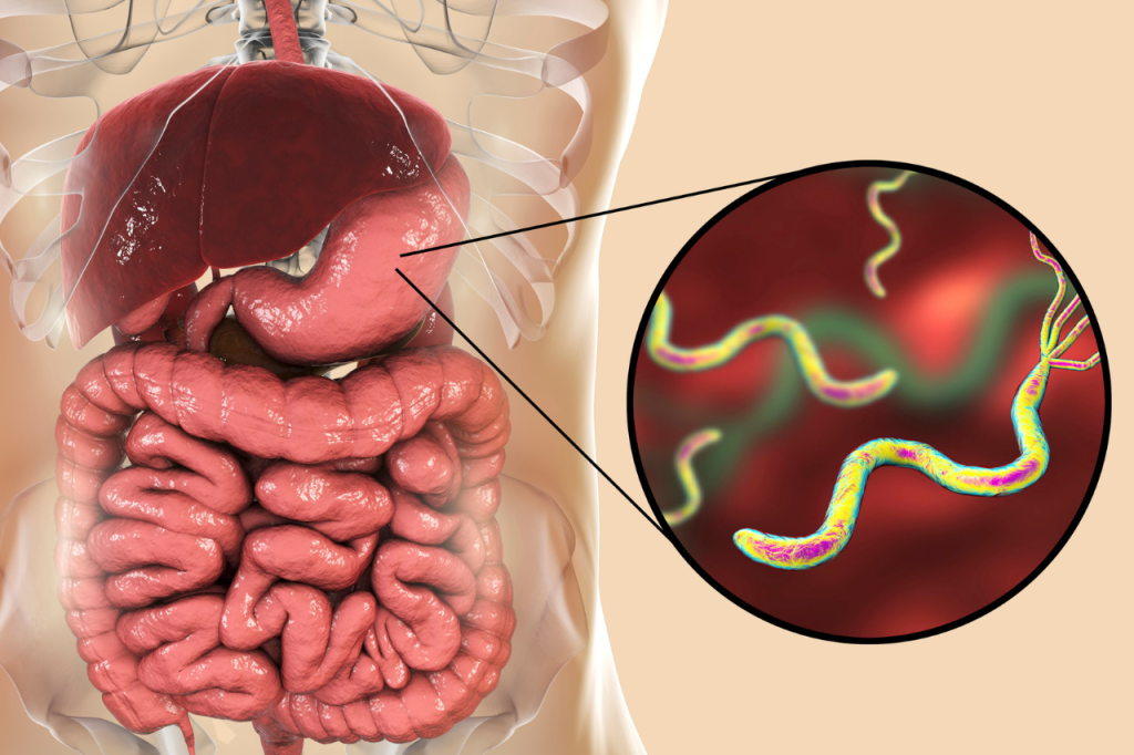 Helicobacter pylori: la bacteria universal que afecta a personas en todo el mundo