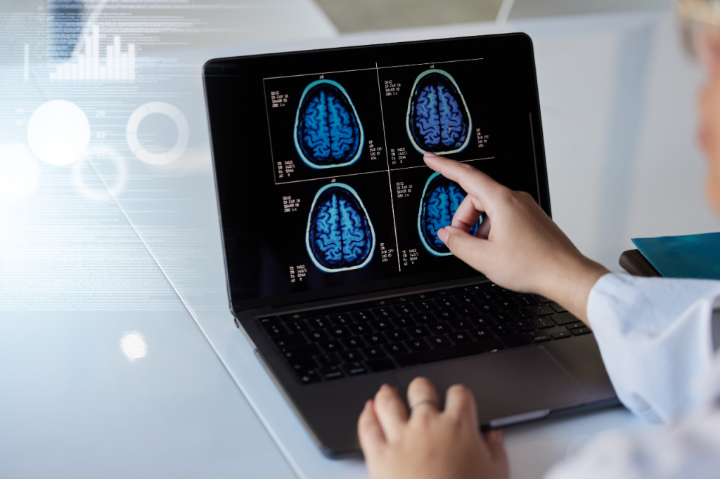 desarrollo de organoides cerebrales a partir de tejido cerebral fetal humano