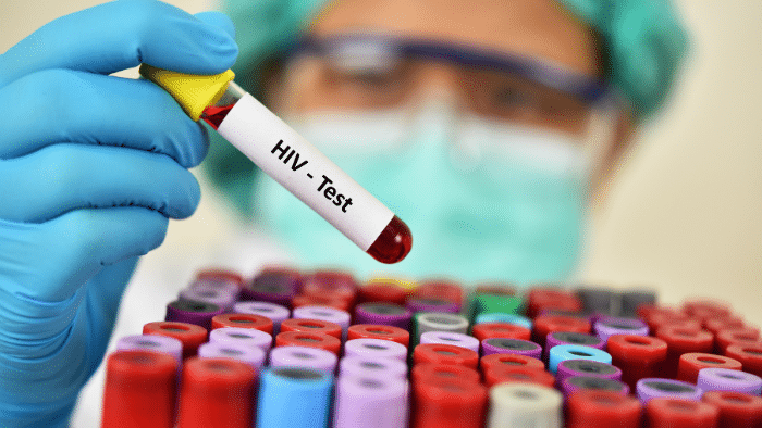 Avances prometedores en la vacuna contra el VIH: La estrategia de anticuerpos neutralizantes