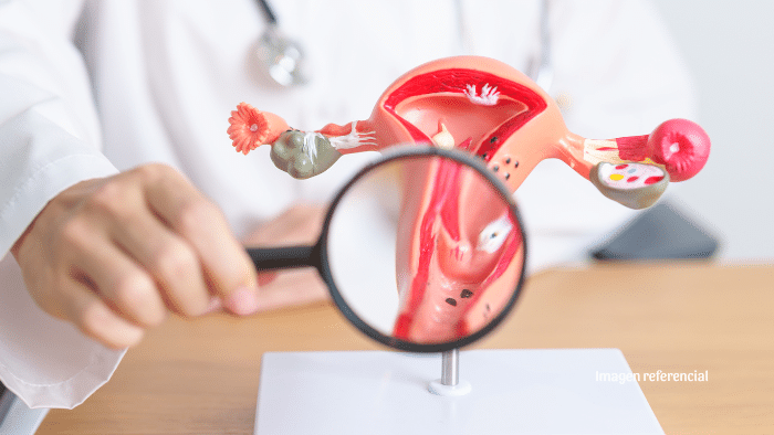 Mayo Clinic desarrolla pruebas caseras con hisopo para cánceres de endometrio y ovario