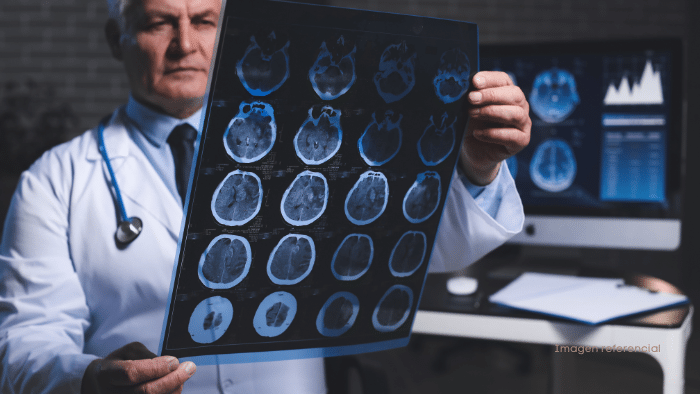 Europa no aprobaría el lecanemab, medicamento contra el Alzheimer