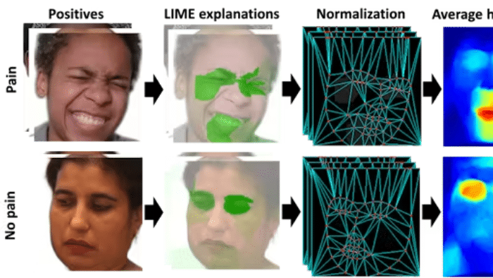 Reconocimiento facial automatizado con IA para evaluar el dolor en parálisis cerebral