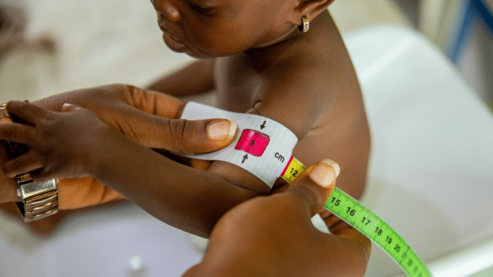 Mortalidad infantil: panorama global y el reto en América Latina y el Caribe