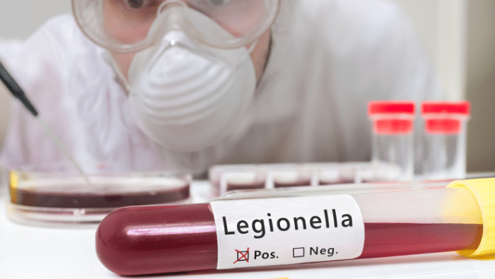 Enfermedad del legionario: Cómo la bacteria Legionella está afectando al mundo