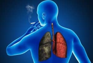Qué es la EPOC: Enfermedad pulmonar obstructiva crónica