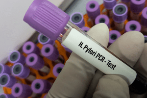 Descubre cómo la bacteria H. pylori, presente en la mitad de la población mundial, puede afectar tu salud. Aprende sobre su historia, cómo se transmite y su relación con enfermedades gástricas.